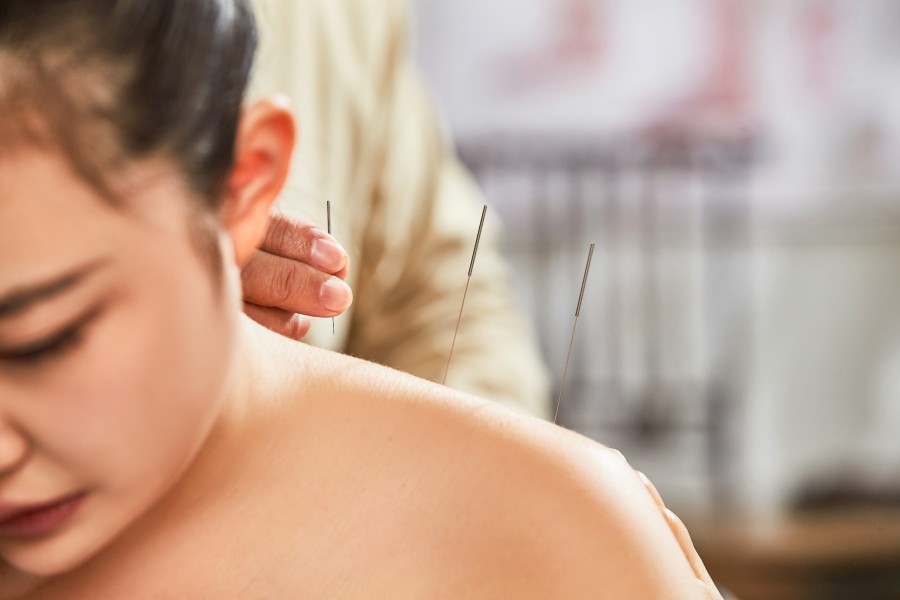 Comment fonctionne l'acupuncture pour arrêter de fumer ?